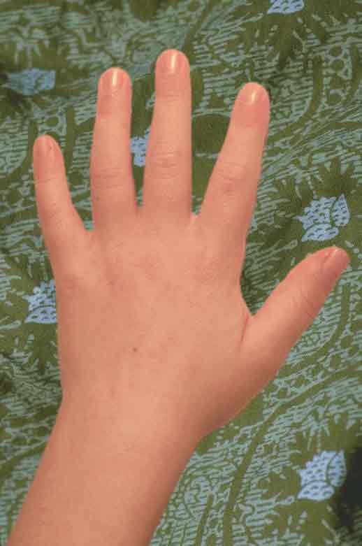 Hand 1